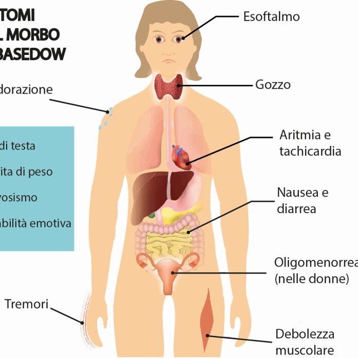 Sintomi-del-morbo-di-Basedow
