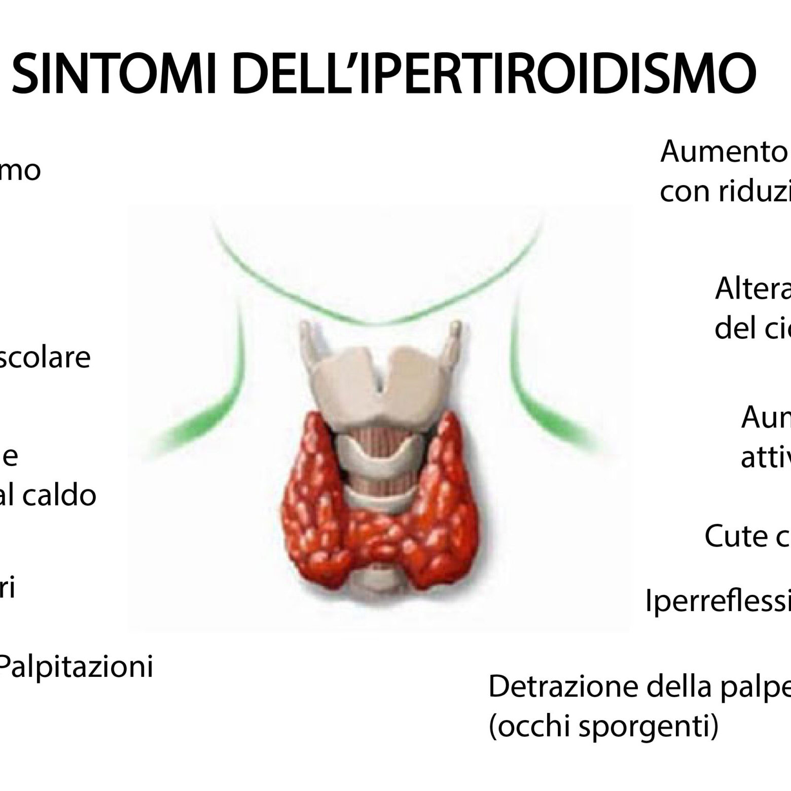 Sintomi-ipertiroidismo