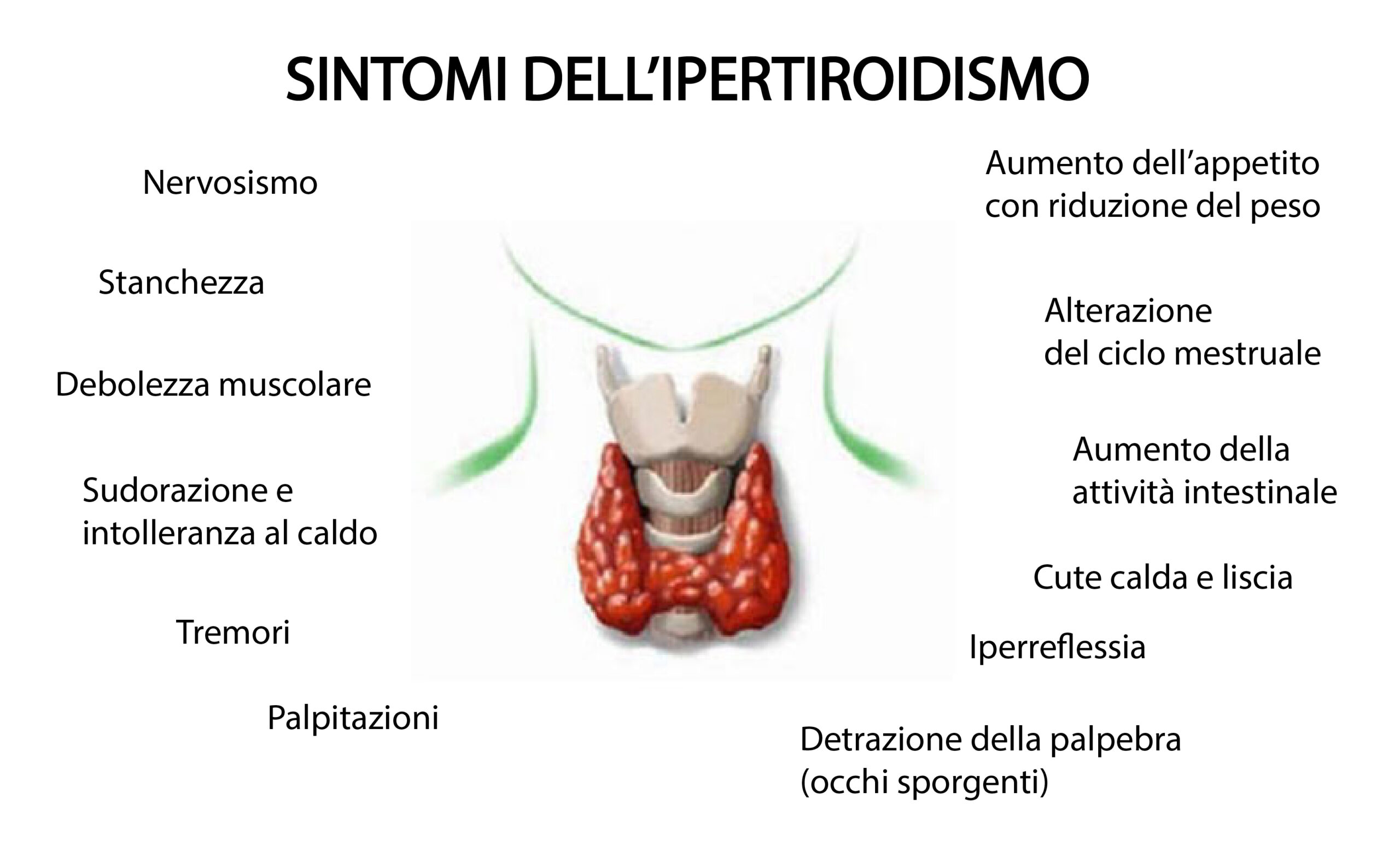 Come Riconoscere I Sintomi Dellipertiroidismo Una Delle Patologie