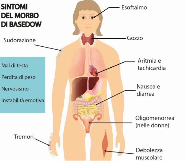 Sintomi-del-morbo-di-Basedow