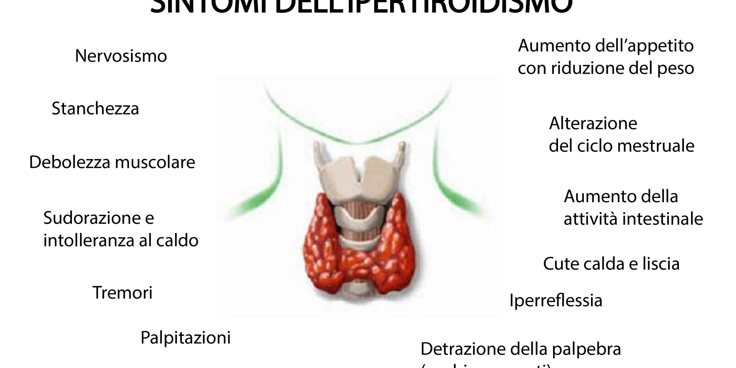 Sintomi-ipertiroidismo